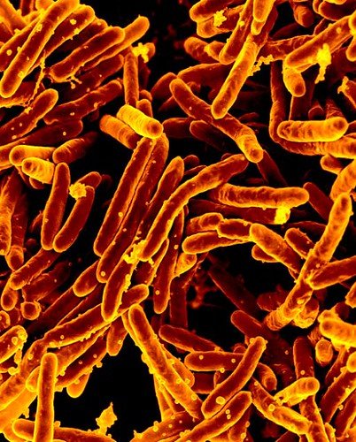 Scanning electron micrograph of a dense field of rod-shaped Mycobacterium tuberculosis bacteria, colored orange.