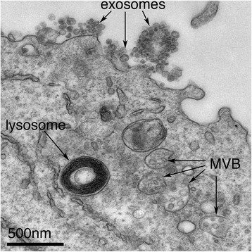 Labeled transmission electron micrograph of an Epstein-Barr virus-transformed B cell, with arrows marking exosomes at the cell surface, a lysosome and multivesicular bodies
