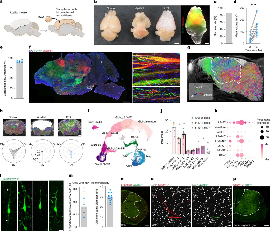 Multi-panel research figure showing human cortical organoids transplanted into a mouse cortical cavity, dorsal photographs of the brains, MRI renderings of the graft and traced nerve fibers reaching the spinal cord.