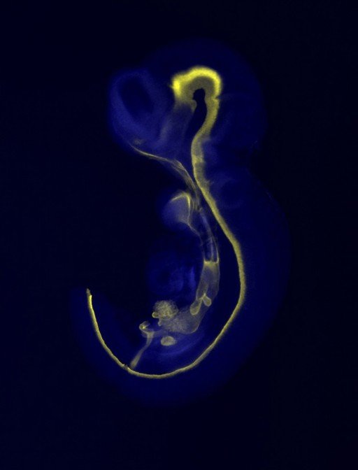 Fluorescence image of a curled mouse embryo with the neural tube traced in yellow from head to tail.