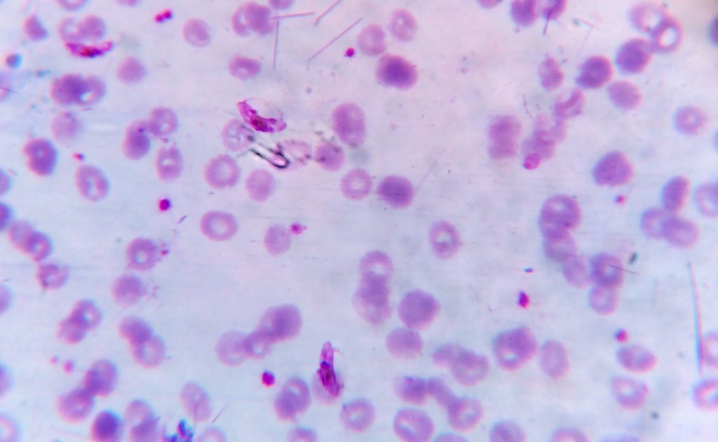 Stained blood film seen under a microscope, with curved Plasmodium falciparum gametocytes among many red blood cells.