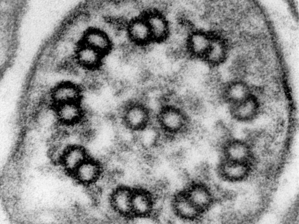 Transmission electron micrograph of a cilium in cross section, showing nine paired microtubule rings arranged around a central pair of single rings.
