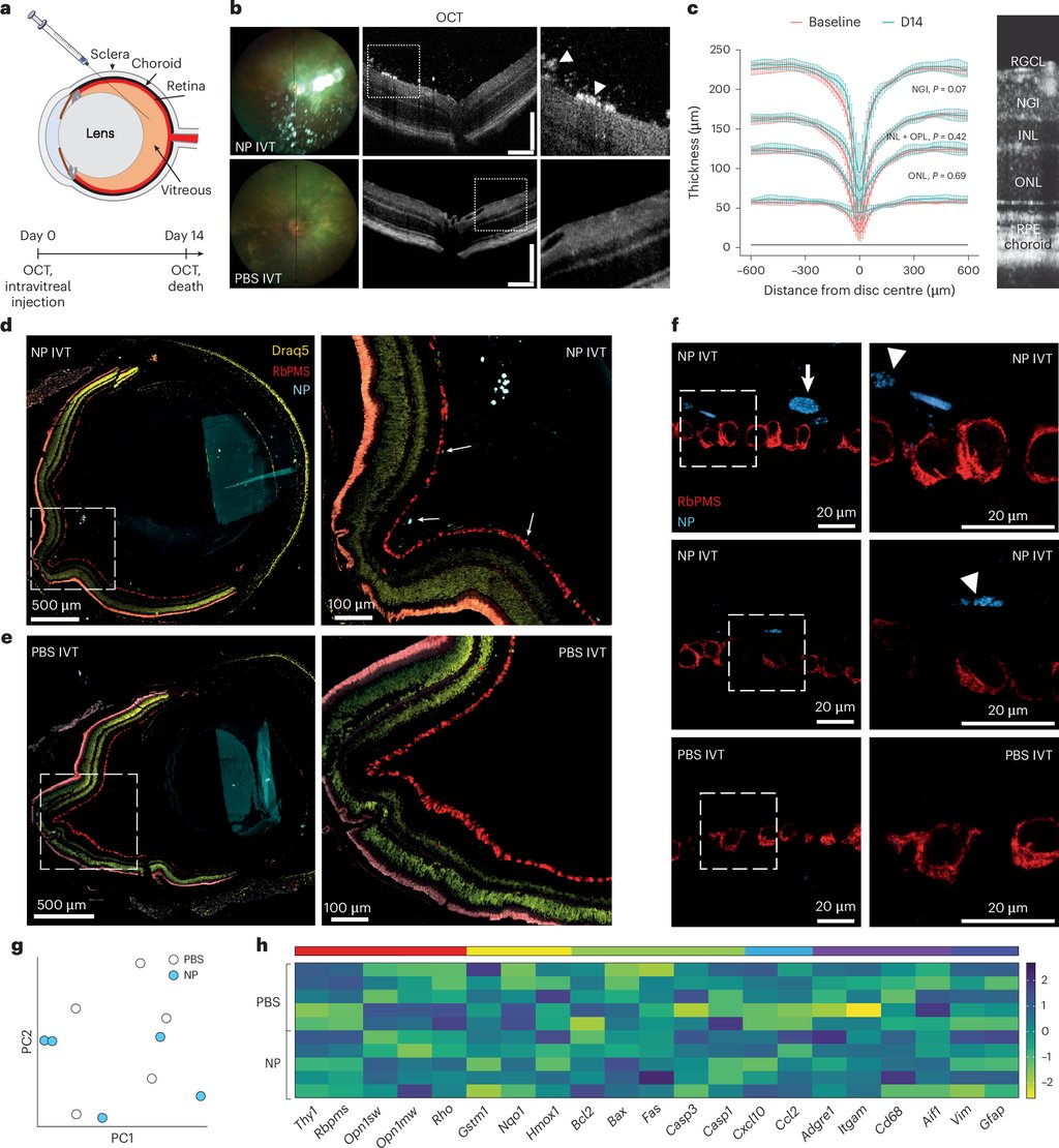 Figure 6 of the study: fundus images, cross-sectional eye scans and confocal images of mouse retina after injection of the particles, with arrowheads marking the particles.