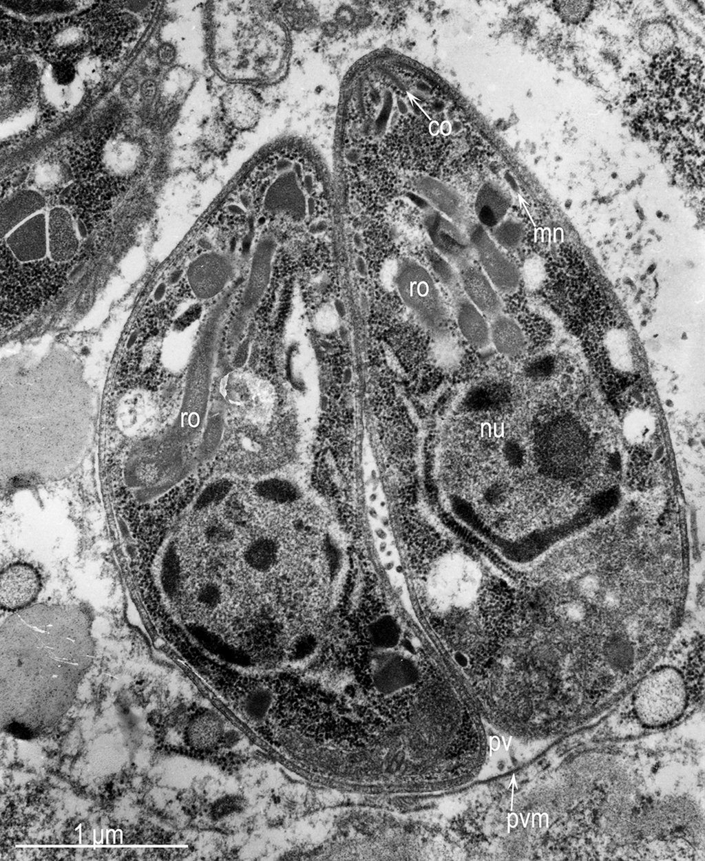 A transmission electron micrograph of two crescent-shaped Toxoplasma gondii tachyzoites inside a host cell.