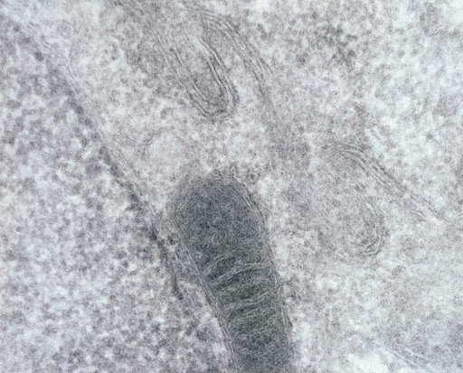 Transmission electron micrograph of a mitochondrion showing internal cristae beside cell membranes.