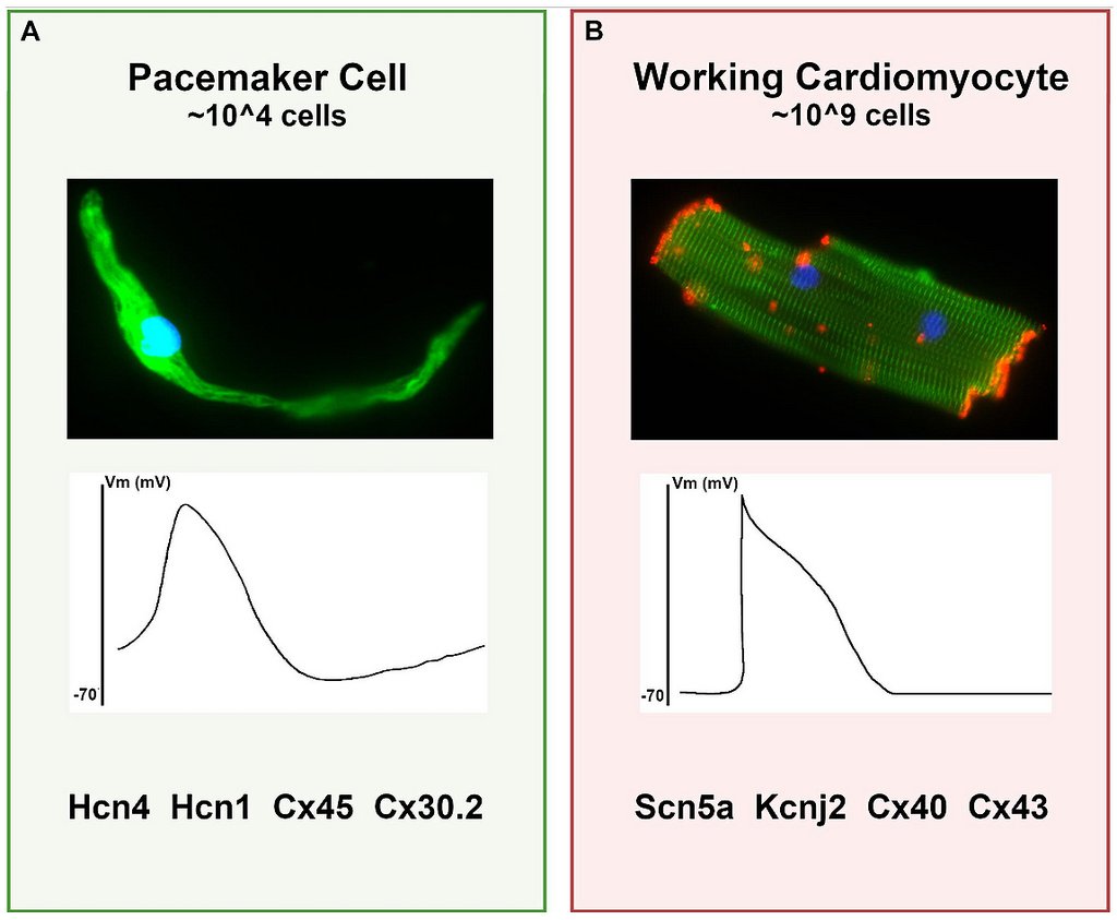Two-panel figure comparing a pacemaker cell and a working heart muscle cell, each with a micrograph and a membrane voltage trace.