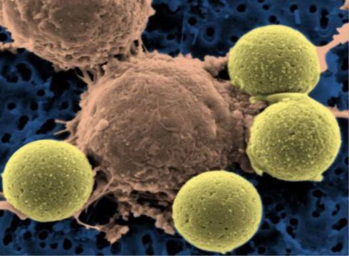 Colorized electron micrograph of brown rounded immune cells attached to several large yellow microbeads against a blue background.