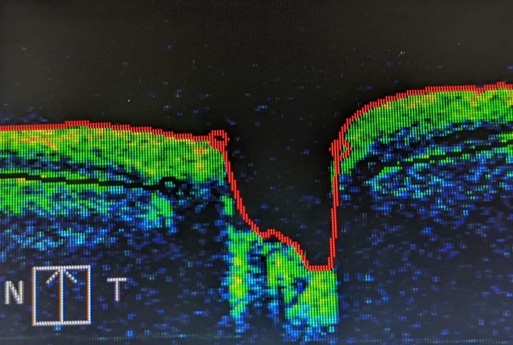 A layered cross-section of retinal tissue displayed on a clinic monitor in green and blue, with a red line tracing the tissue surface.