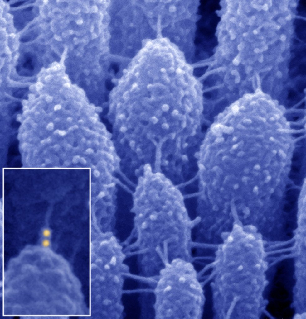 Colorized electron micrograph of tall sensory hairs standing in rows, linked by fine threads, with an inset showing the tip of one hair.