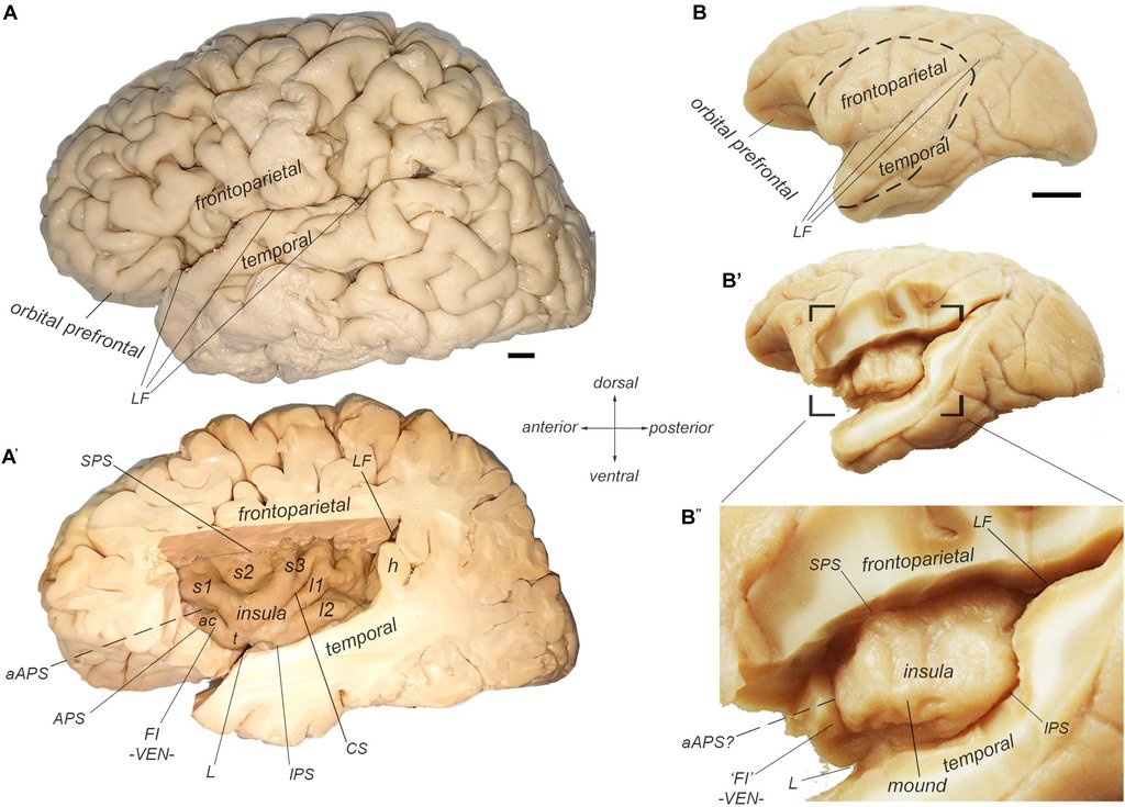 A labeled comparative plate of brain specimens: a whole human brain and a section of it at left, and a macaque brain with a close-up of one region at right.