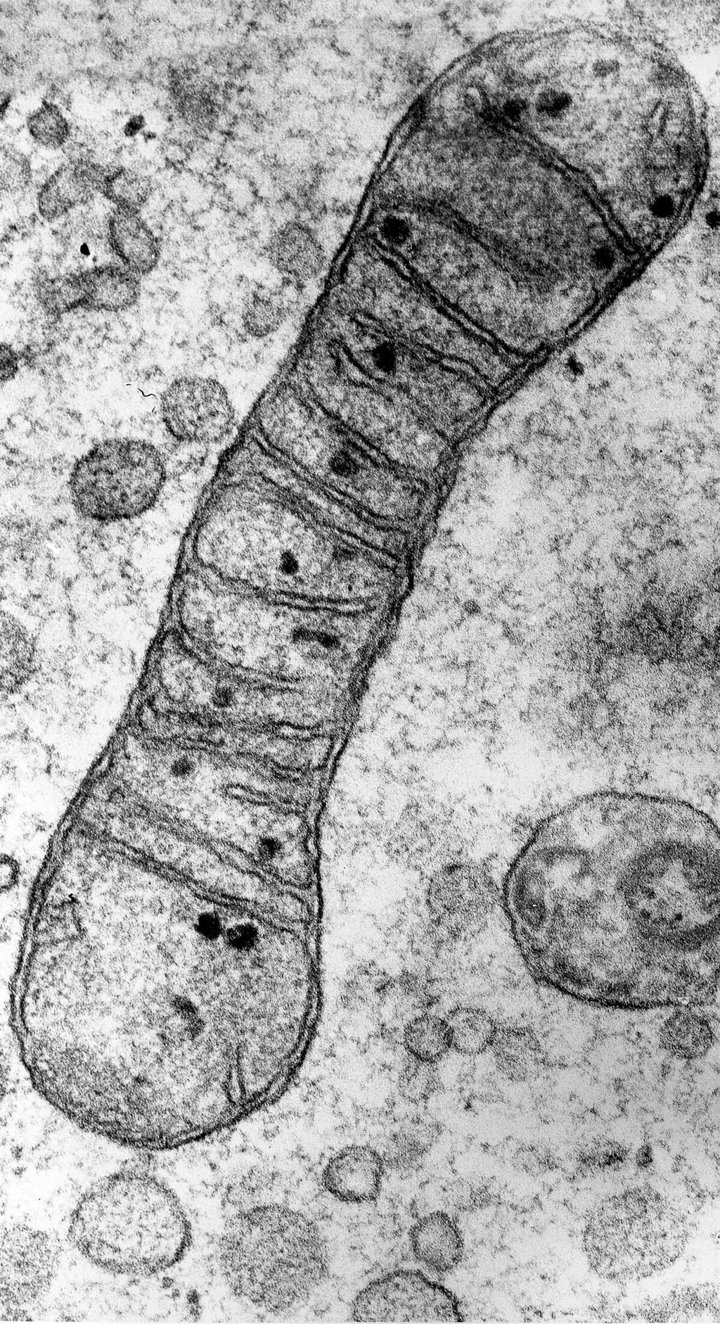 Transmission electron micrograph of a single elongated mitochondrion showing stacked internal membrane folds.