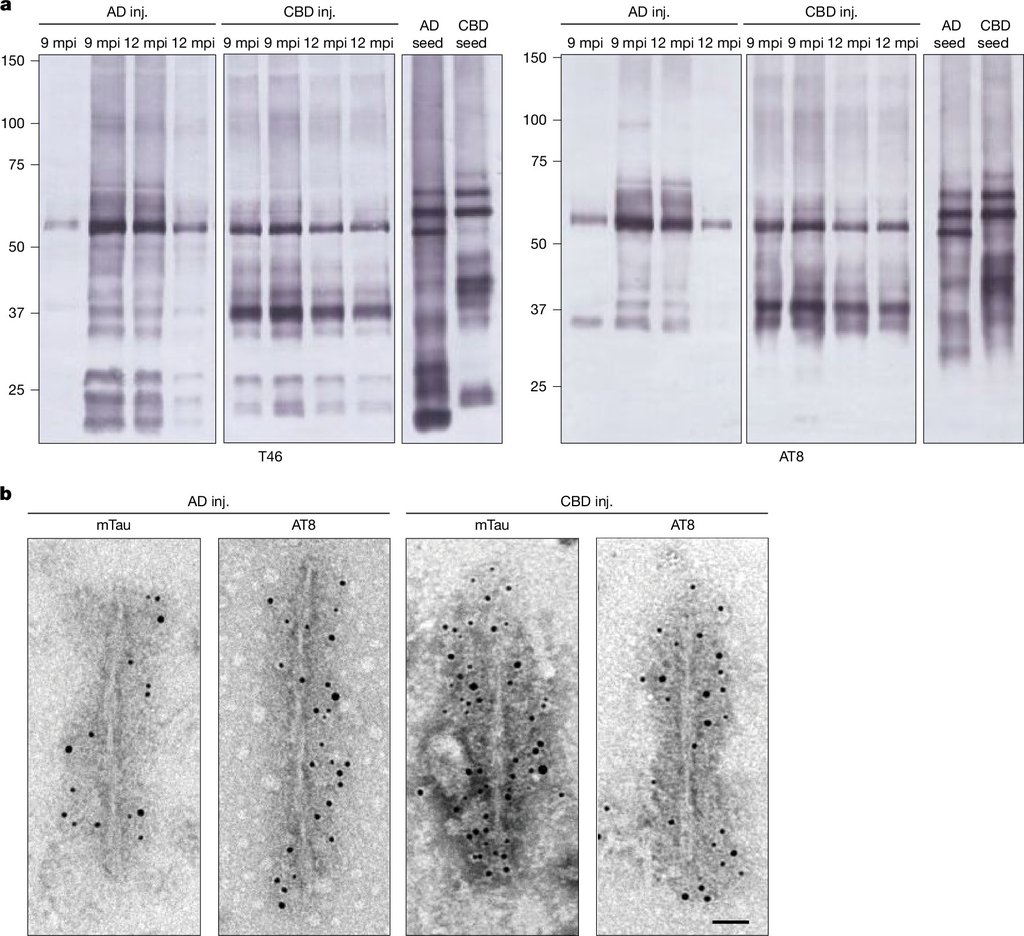 Western blot lanes of insoluble mouse tau beside electron micrographs of filaments studded with dark gold particles.