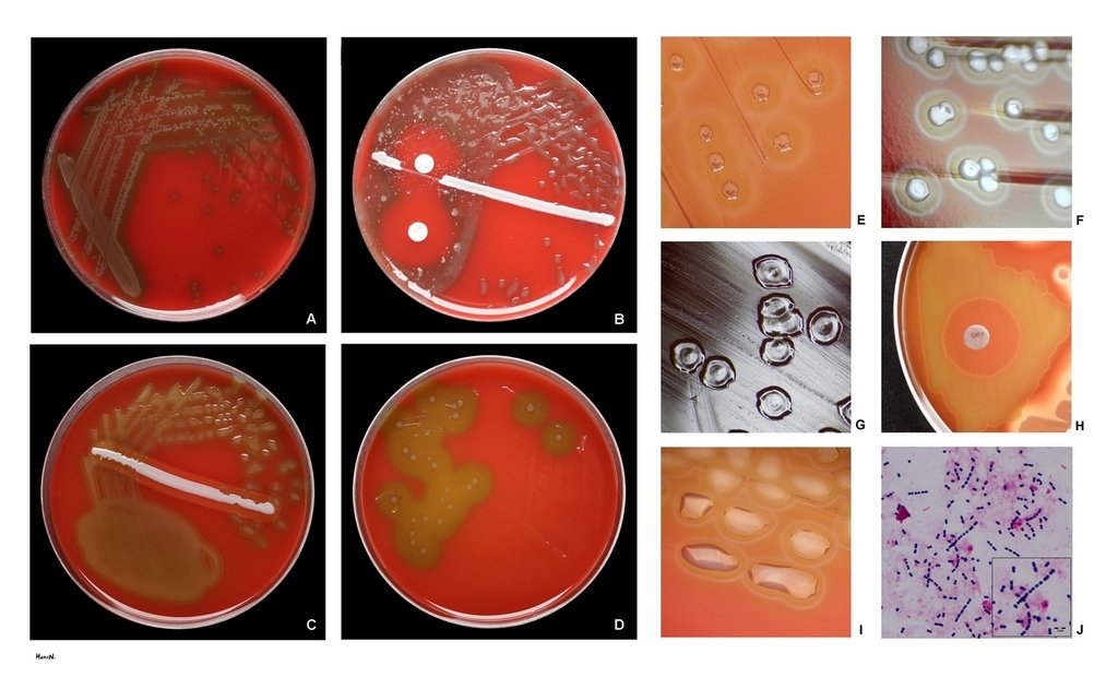 Ten-panel figure of laboratory photographs: bacterial colonies growing on red blood agar in petri dishes, close-ups of colony shape, a disc susceptibility test, and a stained smear.