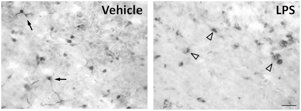 Two side by side micrographs of brain tissue, labeled Vehicle and LPS, with immunostained cells marked by arrows and arrowheads.