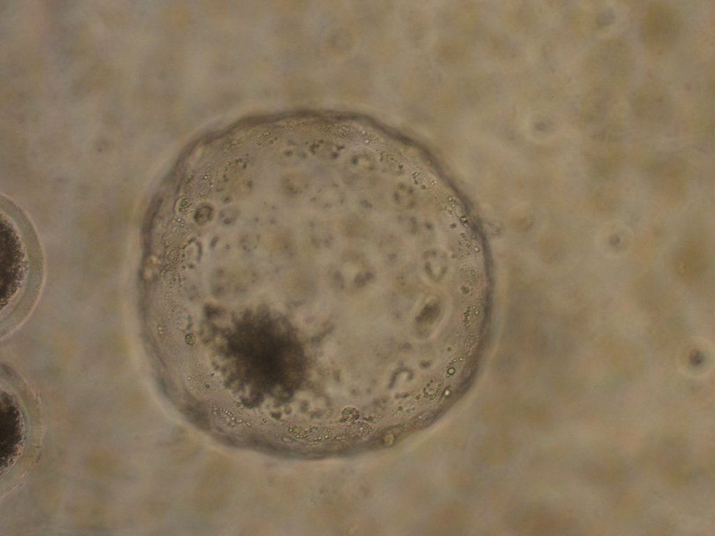 A microscope view of a bovine blastocyst, a near-spherical early embryo with a darker inner cell mass.