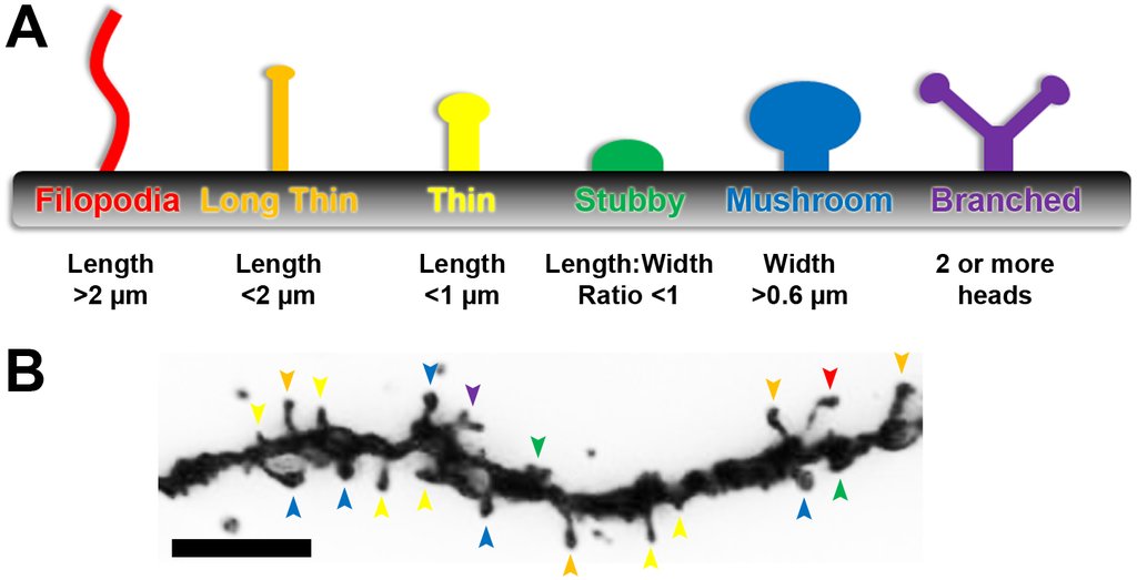 Diagram of six spine shapes labeled filopodia, long thin, thin, stubby, mushroom and branched with their size criteria, above a micrograph of a single dendrite whose spines are marked by colored arrowheads.