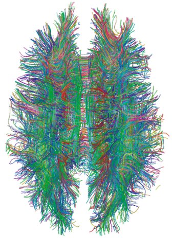 Top down rendering of a whole brain made of thousands of colored fiber streamlines.