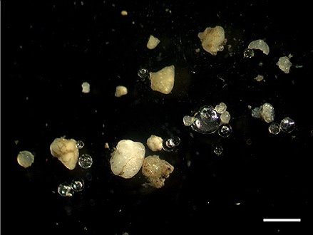 Pale plastic fragments and small clear beads isolated from river mud, photographed under a microscope against a black background, with a white scale bar at lower right.