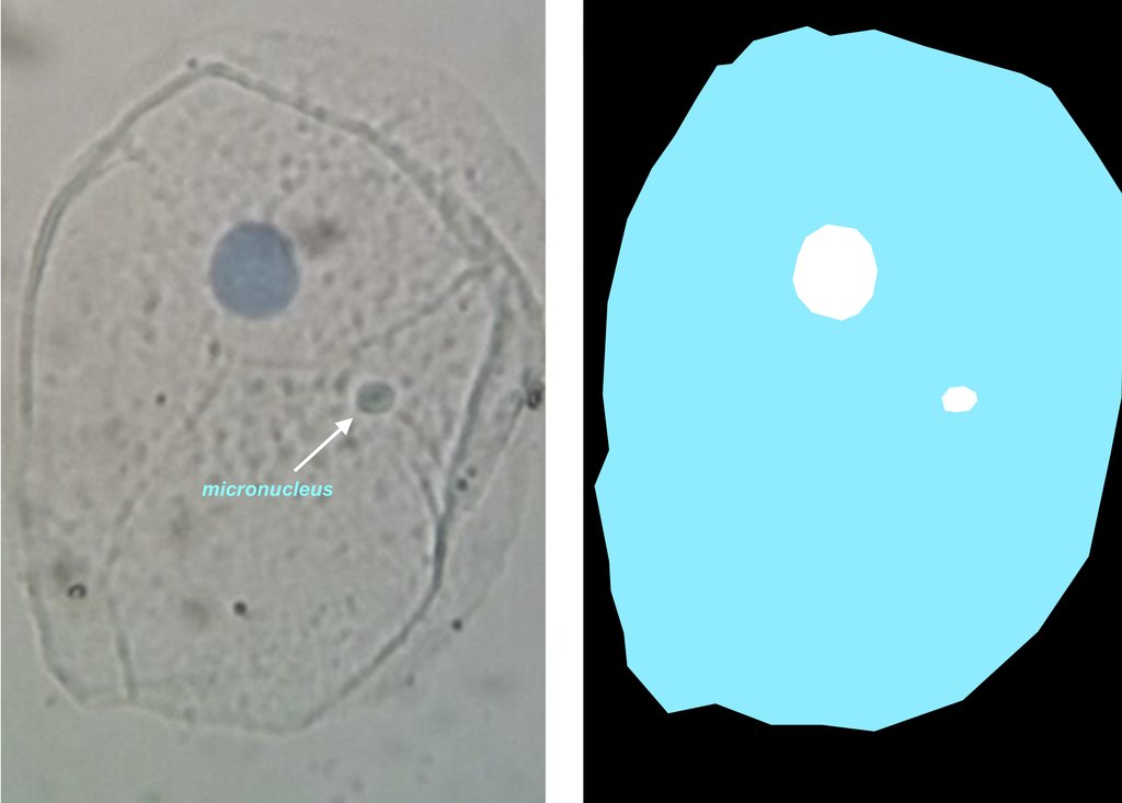 Two panels side by side: at left a cell with a large blue-gray nucleus and a small arrowed body beside it; at right the same cell drawn as a pale outline with the two bodies in white.