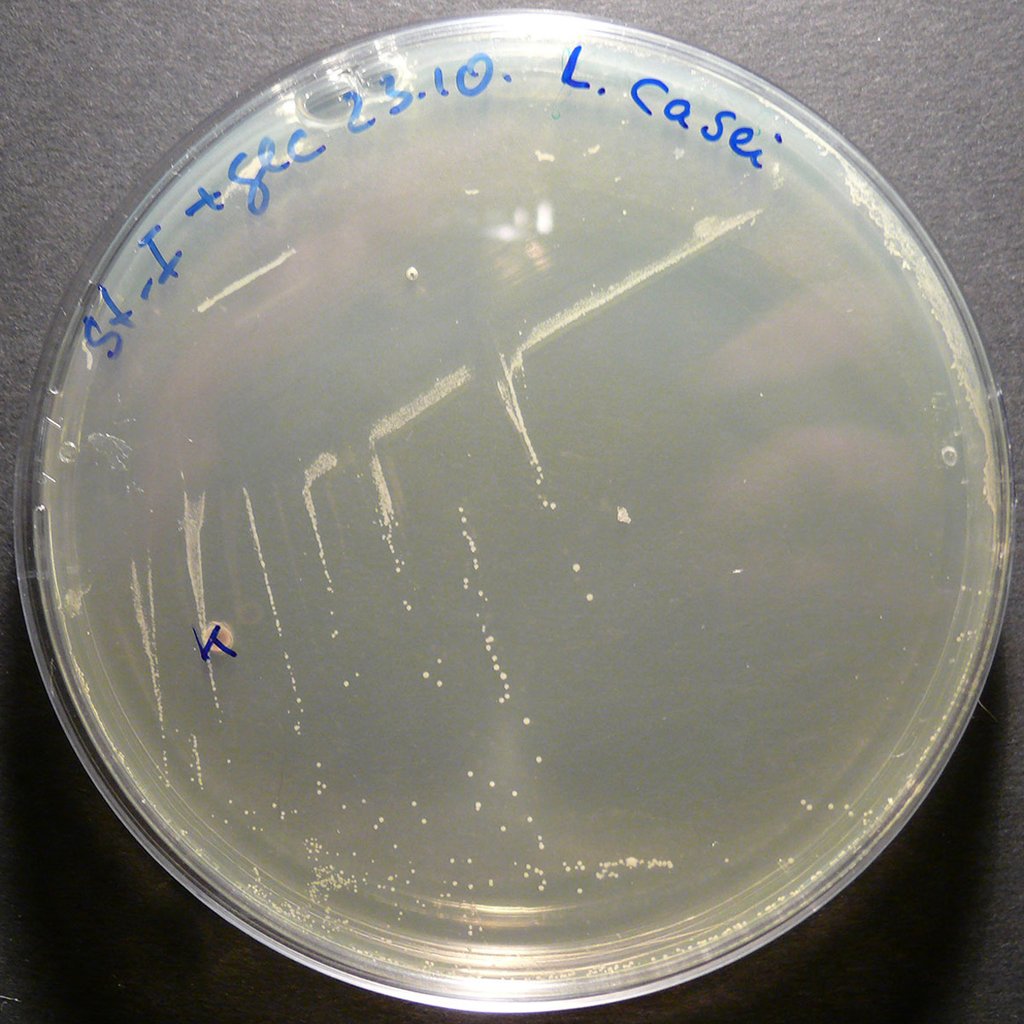 An agar plate streaked with small white bacterial colonies, labeled by hand in blue marker, on a gray benchtop.