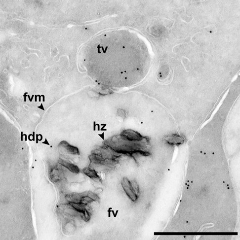 Black-and-white electron micrograph of a malaria parasite's digestive compartment, filled with a cluster of dark angular crystals marked hz, with the compartment and its membrane labeled and a scale bar at lower right.