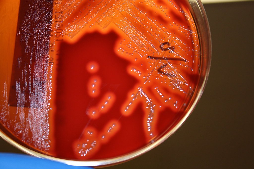 A blood agar plate held up to the light, showing streaked bacterial colonies and bright clear patches in the red medium around them.